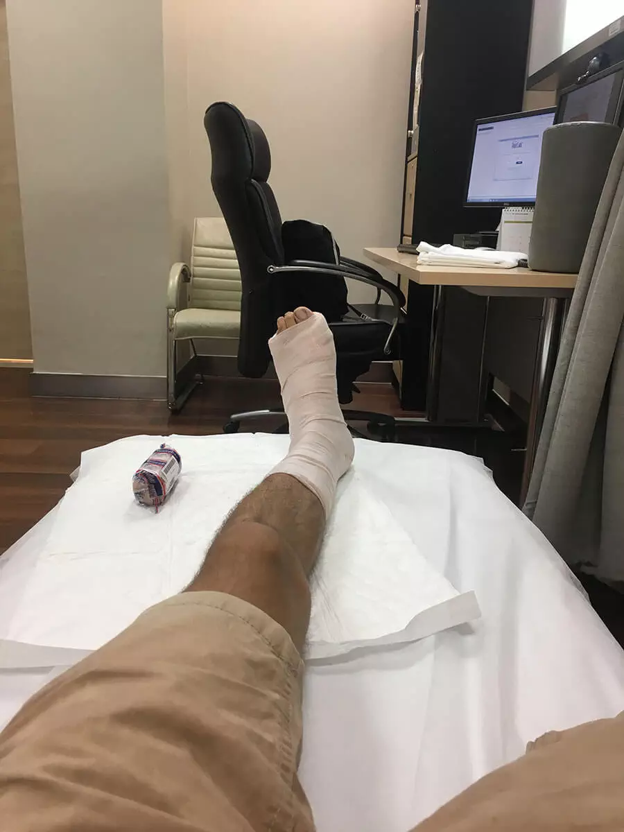 best-travel-insurance-my-broken-foot
